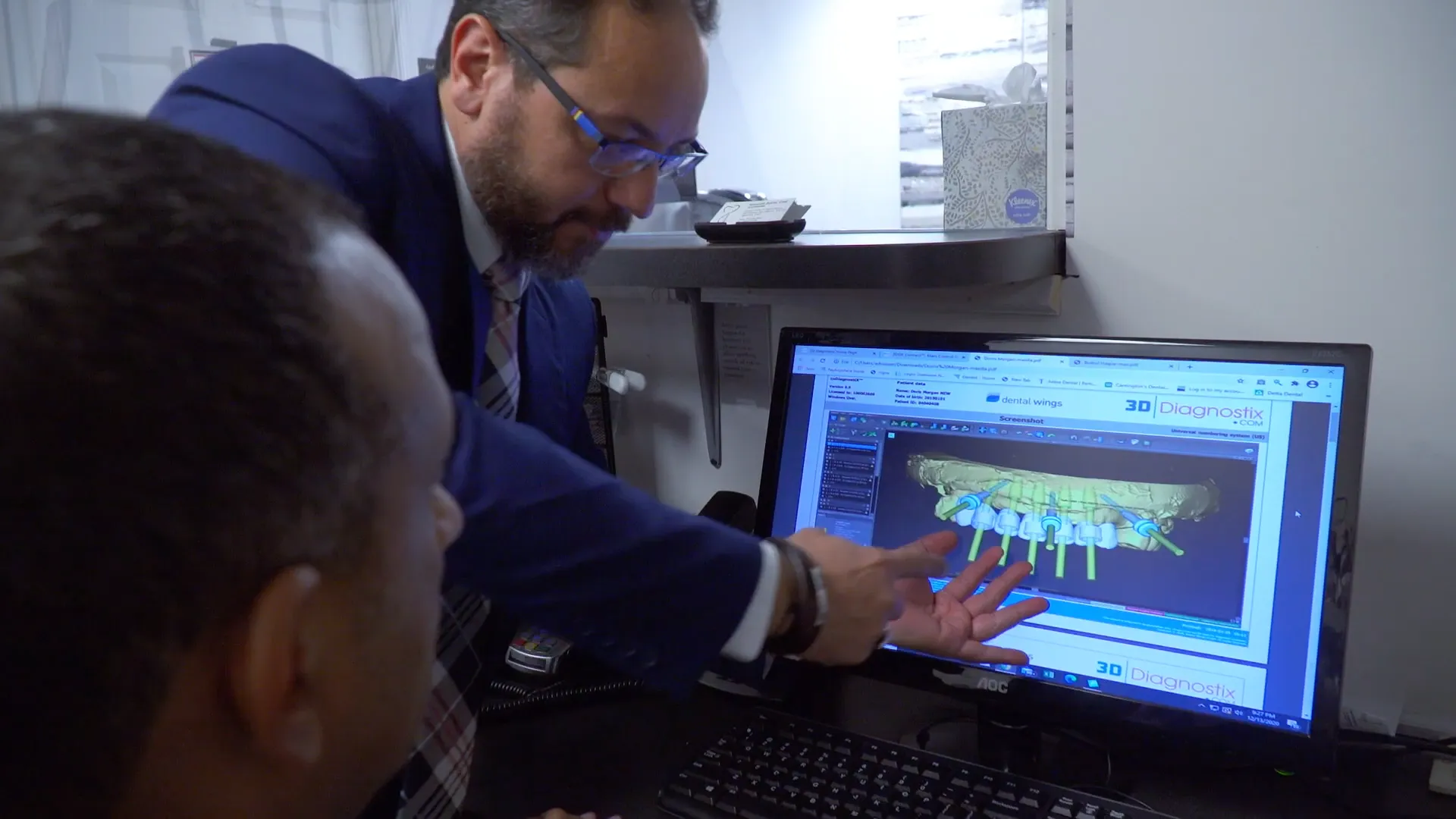 Digital Implant Planning & Guided Surgery